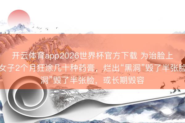 开云体育app2026世界杯官方下载 为治脸上一颗痘，杭州女子2个月狂涂几十种药膏，烂出“黑洞”毁了半张脸，或长期毁容